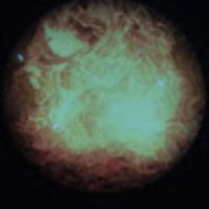 Meet your Posher, Angel